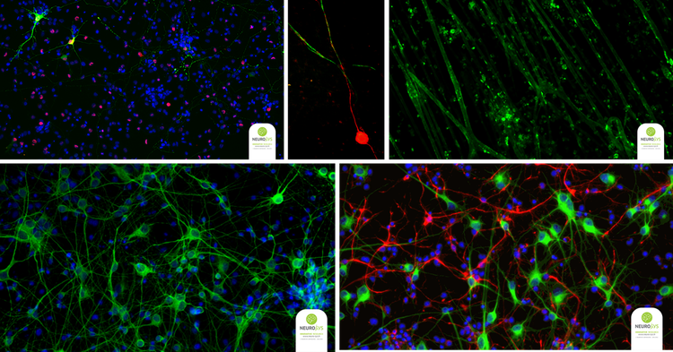 Neuromuscular Junctions, Myelination Kinetics and Glial Cell Proliferation