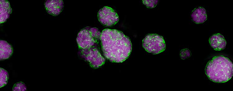 Spheroids for cancer research