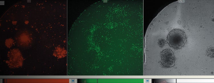 T-cells (T lymphocytes) and TL channel