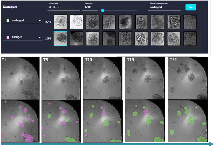 IN Carta during the deep learning segmentation to easily generate masks for organoids