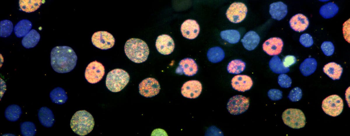 Improved cell counting method using transmitted light on the SpectraMax ...