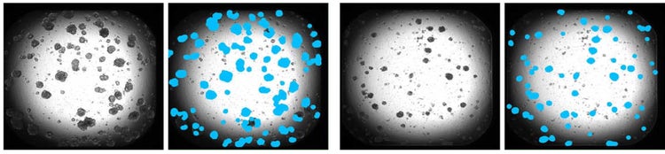 TL images, identifying organoids and applying masks used to calculate the area covered by organoids in each image