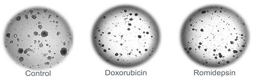 TL images of untreated organoids and organoids treated with compounds (doxorubicin 60 μM, romidepsin 10 μM)