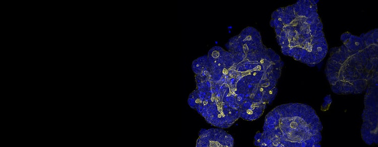 Patient-derived Organoids