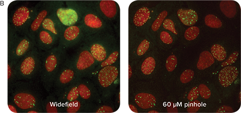 Images acquired with a 40X PA (0.95NA) objective in confocal mode (right) illustrate improved nuclear puncta visibility