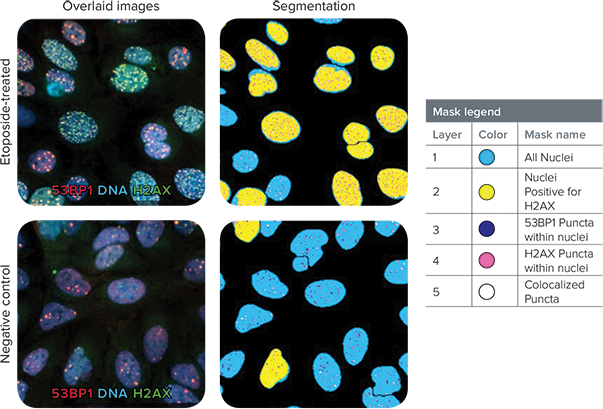 Confocal images reveal co-localized puncta in response to etoposide treatment