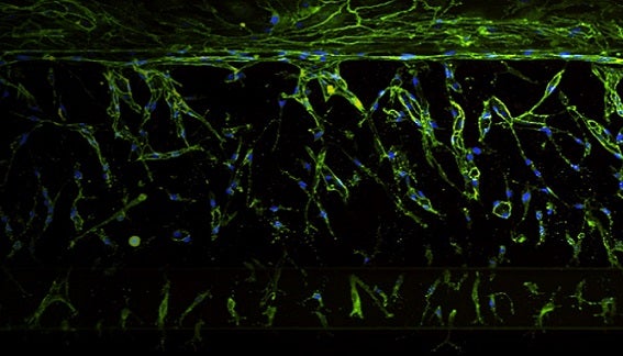 Automation of an organ-on-a-chip assay: automated culture, imaging, and analysis of…