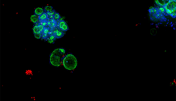 Novel patient-derived colorectal cancer organoid platform for automated high-throughput…