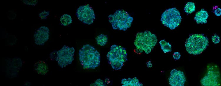 organoid assays