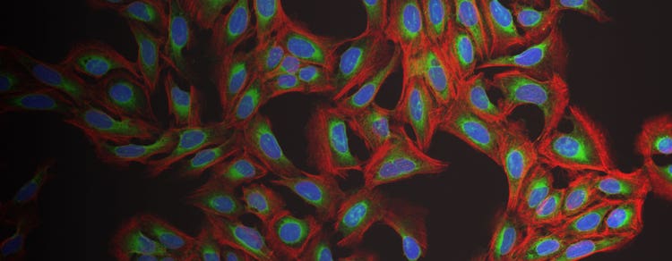 Cell Painting assay