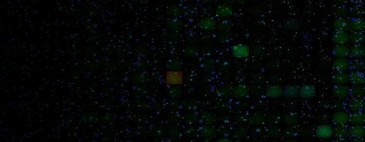 T-cell and patient-derived organoid interaction