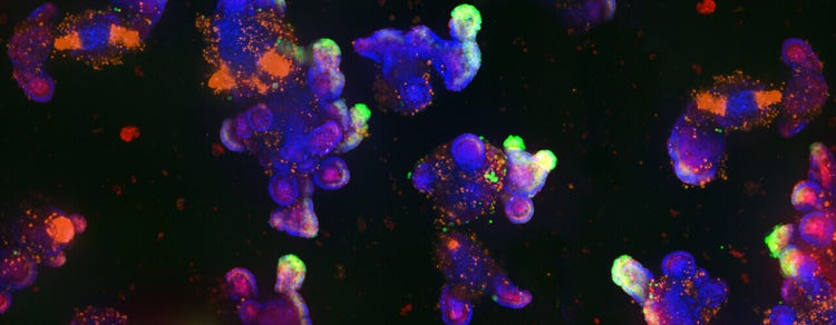 Organoid Models