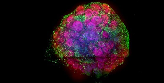 Brain Organoids