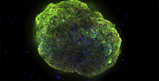 Cardiac organoids or cardioid platform