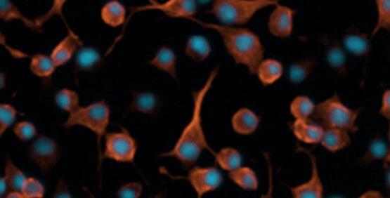 Neurite outgrowth analysis