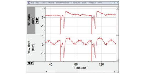 Extracellular field potential recordings