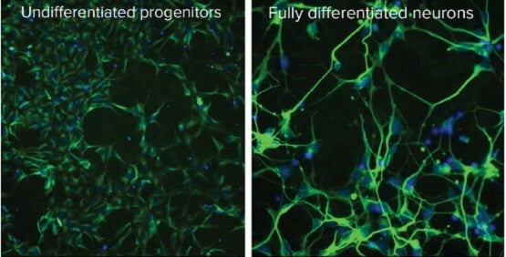 Neuronal stem cell expansion and differentiation