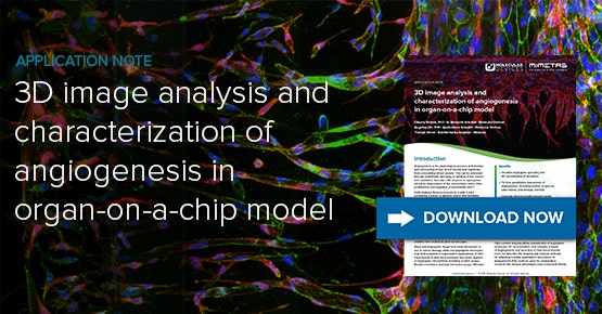 3D image analysis and characterization of angiogenesis