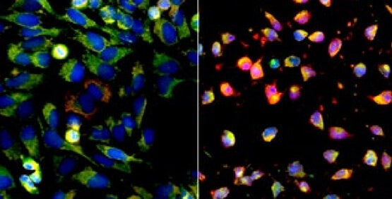 Translocation and Translocation-Enhanced