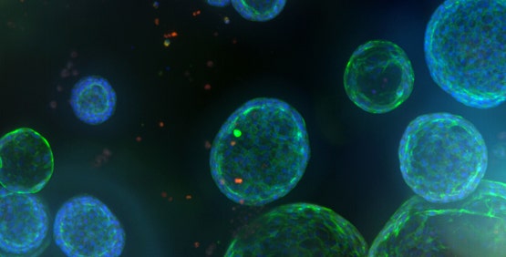 Pulmonary (Lung) Organoids