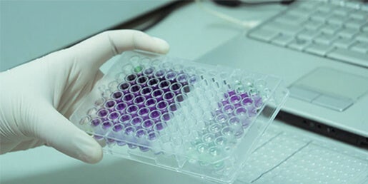 Protein Quantitation (BCA, Bradford, Lowry assays) measured directly, via absorbance at 280 nm in a UV spectrophotometer