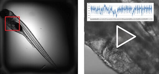 Heart beat in zebrafish