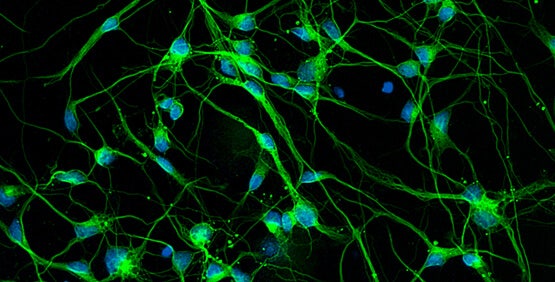 Neuron morphology