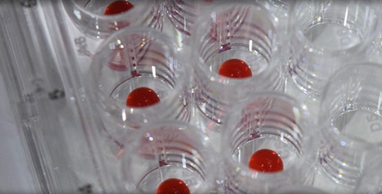 3D Bioprinting