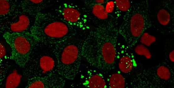 Cellular Imaging Systems for high-content imaging (HCI) and high-content analysis (HCA)