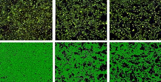 Stem cells differentiated into Cardiomyocytes