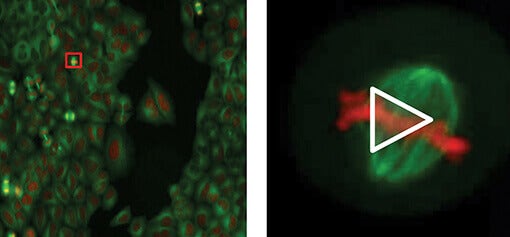 Mitotic spindle