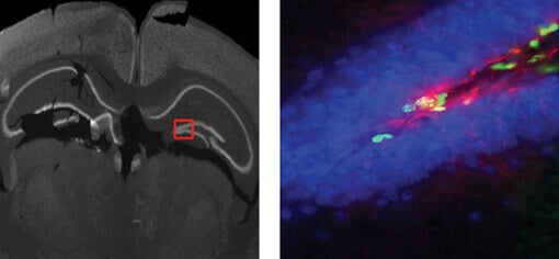 Hippocampus in a brain slide