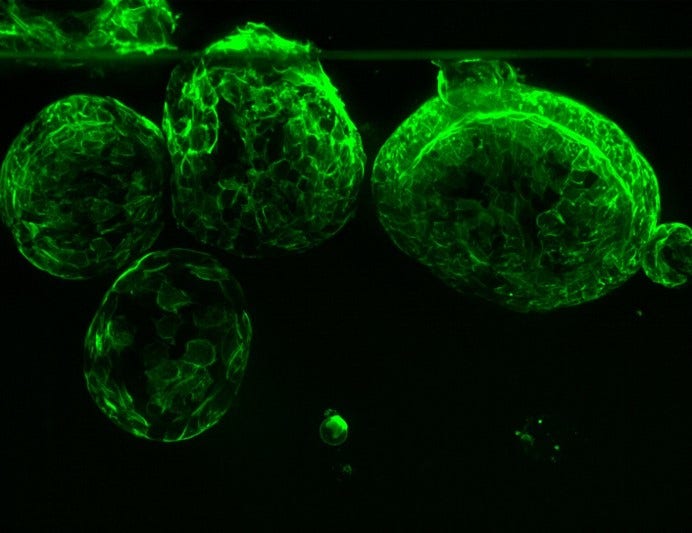 Organoid vs. Spheroid