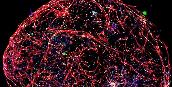 Brain Micro-tissues