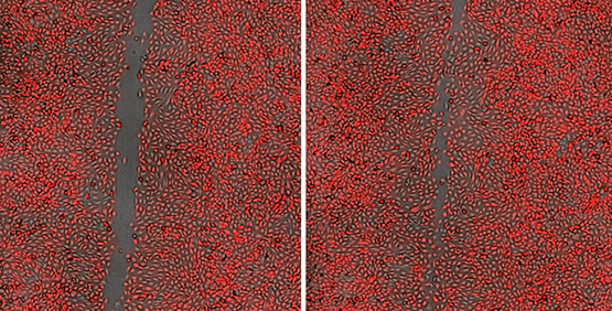 Cell Migration Assays