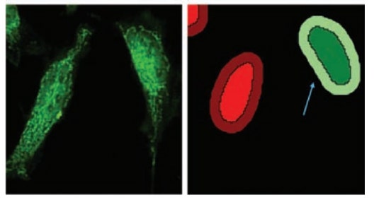 Improve nuclear translocation assay results using image deconvolution