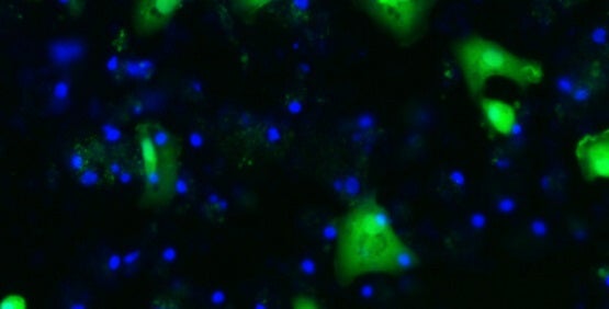 Stem cells differentiated into hepatocytes