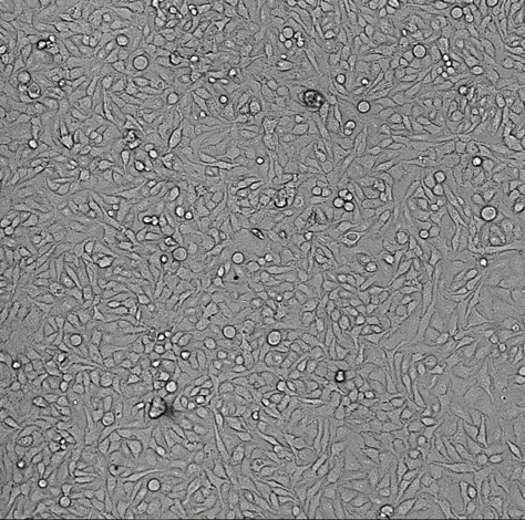 Counting cells with transmitted light