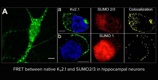 Synchronizing Electrophysiology And Imaging Studies