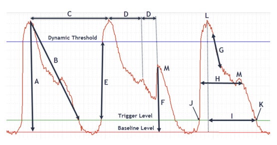 Assessment of compound-induced pro-arrhythmic effects in vitro