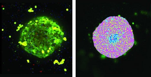 3D cardiac spheroids