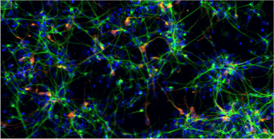 Neurons, neurite outgrowth