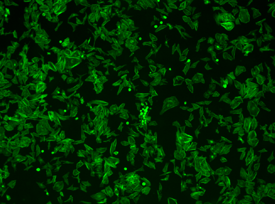 Image cytometry a cell counting technique