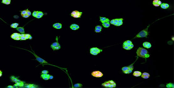 Cells are grown in an extracellular matrix (ECM) to mimic an in vivo environment