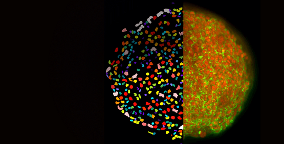 Laser Illumination highly-complex cell-based 2D and 3D assays