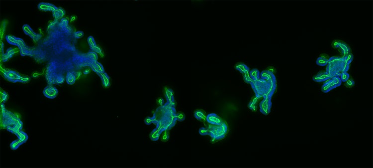 Intestinal organoids are 3D microtissue models that recapitulate structures in the intestinal lumen