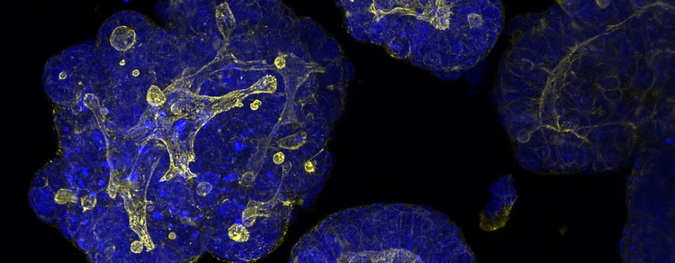 Patient-derived organoids (PDOs)