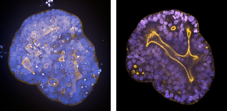 PDO Mini-gut organoid slice