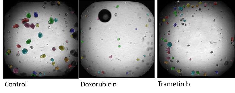 CRC mages of organoids captured on the ImageXpress Confocal