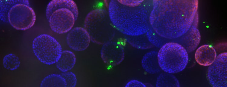 organoid cell cultures